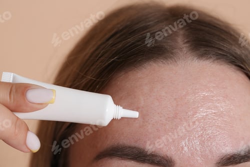 Preview: Woman applying cream onto face on beige background, closeup. Acne treatment