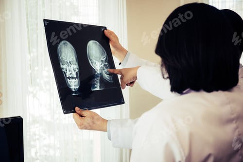 Preview: Close up of doctor holding x-ray, x-ray film of patient at hospital.