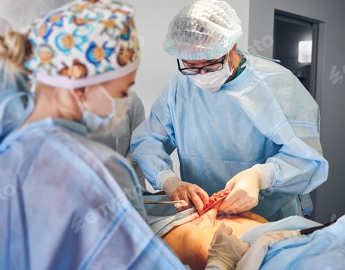 Preview: Medical workers doing abdominoplasty or tummy tuck surgery in clinic.