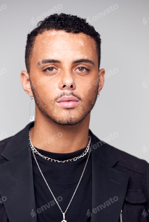 Preview: Studio Portrait Of Young Man With Skin Pigmentation Disorder Looking At Camera