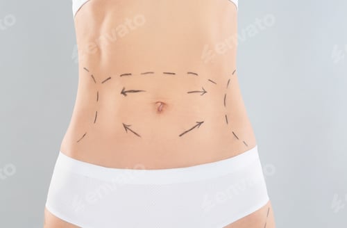 Vista previa: Woman with marks on body for cosmetic surgery operation against grey background, closeup