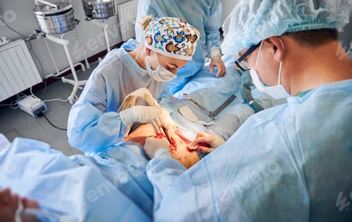 Preview: Doctor and assistant doing abdominoplasty surgery in clinic.
