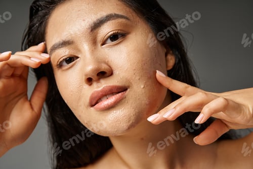 Preview: portrait of young asian woman with brunette hair and acne on wet face posing on grey background