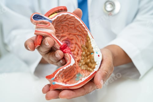 Preview: Stomach disease, doctor with anatomy model for study diagnosis and treatment in hospital.
