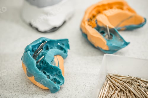 Preview: Denture concept