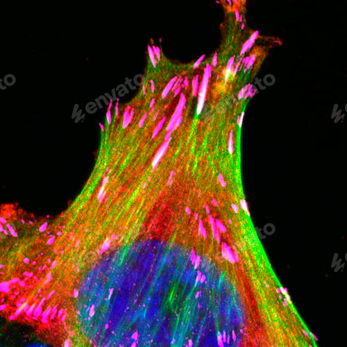 Preview: Enlarged focal adhesions in breast cancer cells