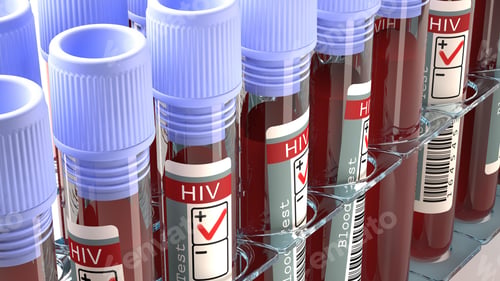 Preview: HIV virus, medical concept, Human Immunodeficiency Virus Positive test