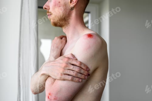Preview: Man with many wounds on skin