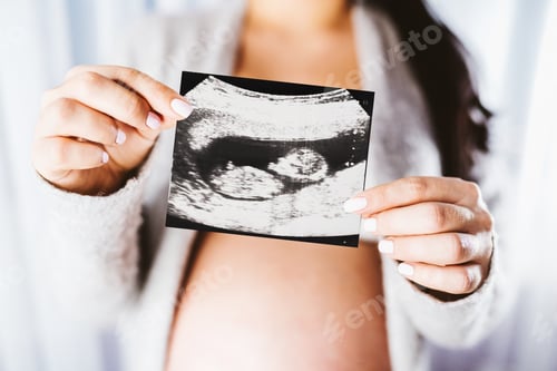 Preview: Pregnant woman holding ultrasound shot