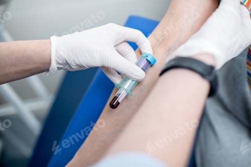 Preview: Woman taking blood for test in the laboratory