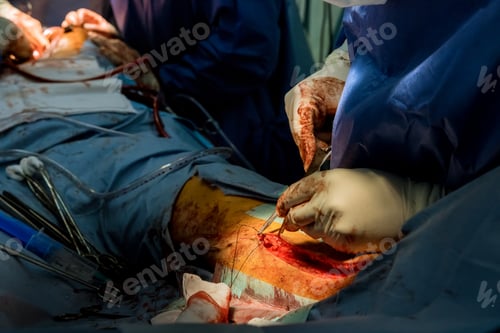 Preview: It is not uncommon for doctors in the operating room to sew up an injured leg