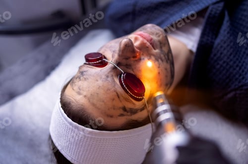 Preview: Beautician holding beauty laser near woman face covered with carbon mask