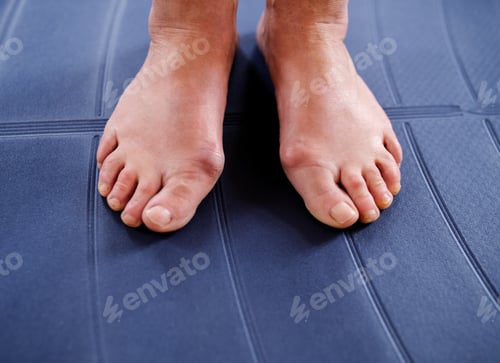 Preview: Top view of bare feet of older woman suffering from hallux valgus