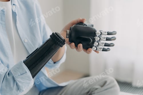 Preview: Artificial hand and arm with wrist joint. Disabled woman disassembling high technology prosthesis.