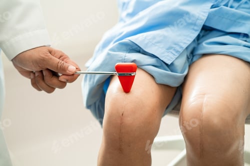 Preview: Asian doctor use hammer knock senior woman patient to check knee reflex, nerve and muscle