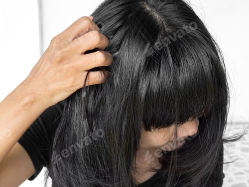 Preview: Dandruff Itchy scalp, woman chtatch hair