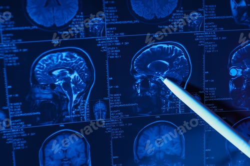 Preview: MRI or magnetic resonance imaging of the head and brain. Close up