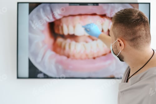 Preview: Doctor dentist showing patient's teeth