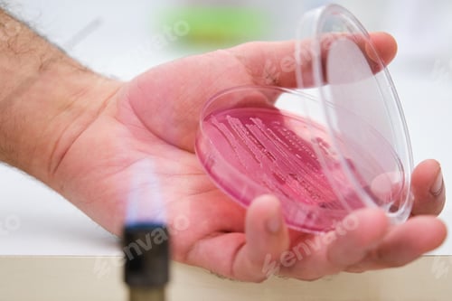 Preview: Scientific hand holding bacterial cultures in a pink Petri dish.