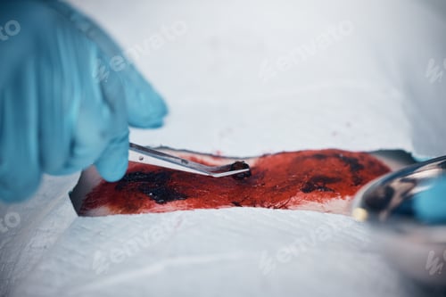 Preview: Doctors, nurses or surgery hands on cut patient in hospital emergency room for stomach ulcer, heart