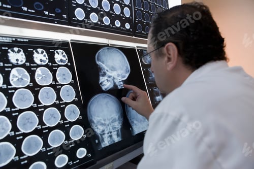Preview: Doctor pointing to skull xray image on lightbox