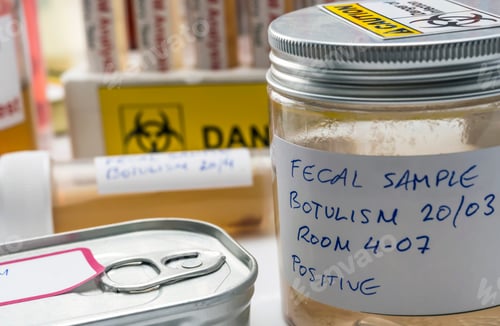 Preview: Fecal sample of a person infected with botulism