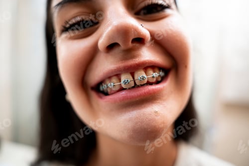Preview: smiling brunette teenage girl with orthodontic dentures