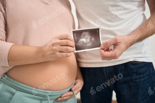 Preview: Husband and wife hugging holding ultrasound image of baby