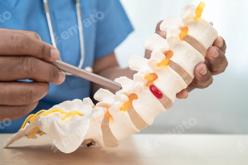 Preview: Doctor with lumbar vertebra bone skeleton and nerve model for treatment
