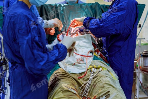 Preview: As part of the heart operations due to coronary heart disease that are being performed in the