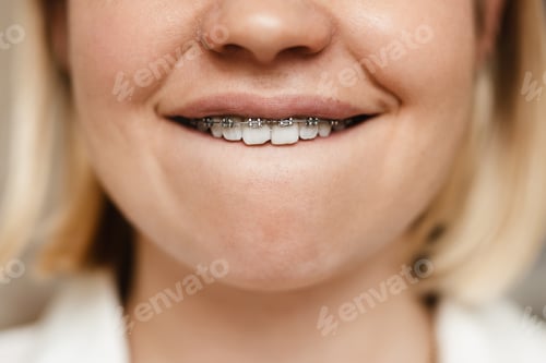 Preview: Young woman showing her brace while smiling at camera indoors