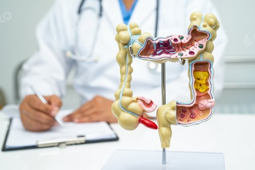 Preview: Intestine, appendix and digestive system, doctor holding anatomy model