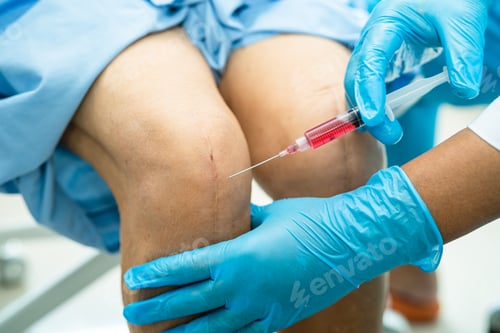 Preview: Asian doctor inject Hyaluronic acid platelet rich plasma into the knee of senior woman