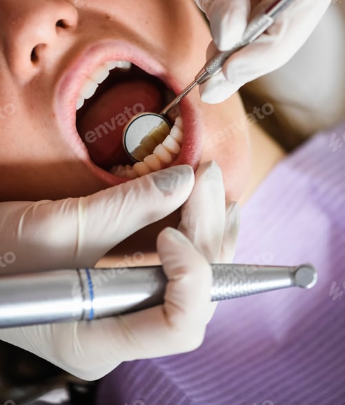 Preview: Dental Check