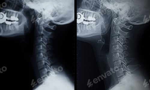 Preview: Neck X-ray detail