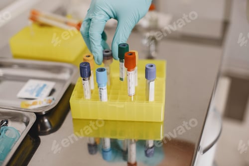Preview: Nurse taking blood sample from patient at the doctors office