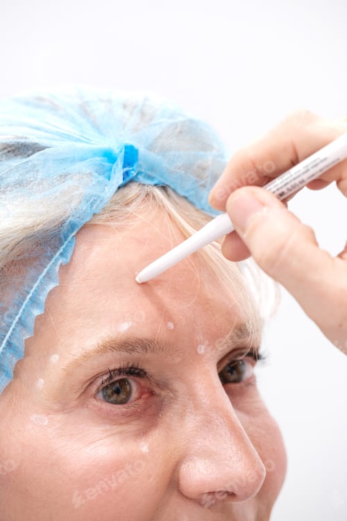 Preview: Close up picture of Experienced doctor using a marker for a woman anti-aging trearment