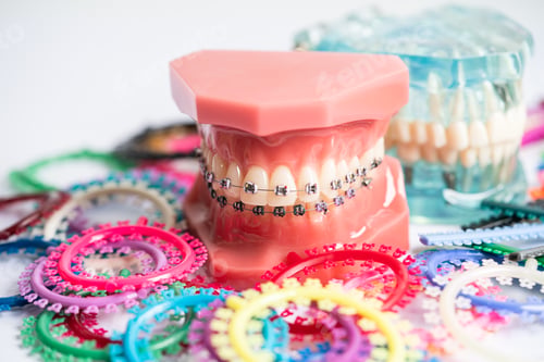 Preview: Orthodontic ligatures rings and ties, elastic rubber bands on orthodontic braces, model