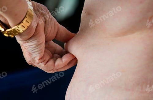 Preview: Closeup of obese elderly woman