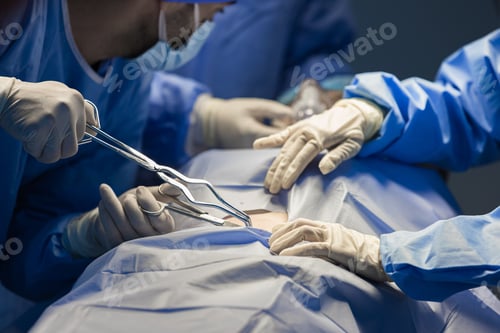 Preview: Medical Team Performing a Surgical Operation