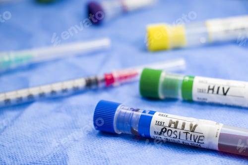 Preview: Closeup of HIV POSITIVE test tubes on the table in a laboratory