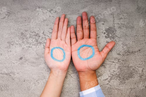 Preview: Two Open Hands With Blue Circles Drawn On Palms, Symbolizing Diabetes Awareness