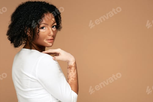 Preview: Portrait of African American woman with vitiligo on her face and hands, over pastel or beige