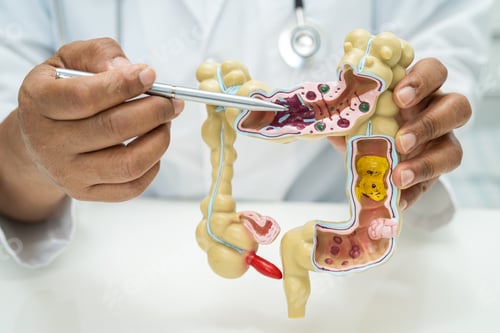Preview: Intestine, appendix and digestive system, doctor holding anatomy model