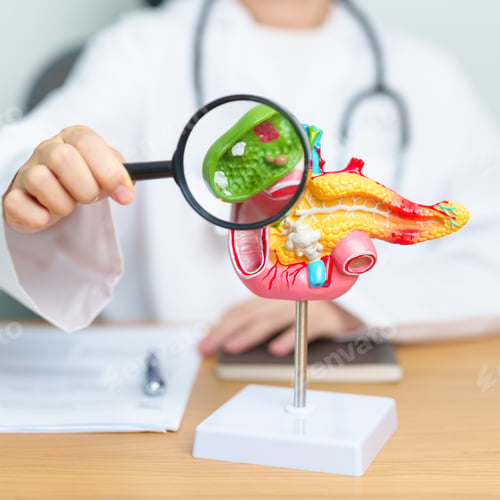 Preview: Doctor with human Pancreatitis anatomy model with Pancreas