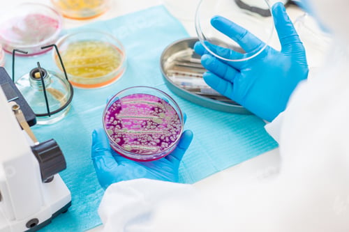 Preview: Examine bacteria in petri dishes in the laboratory. Selective focus.