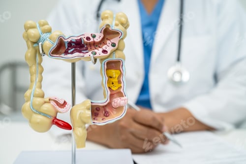 Preview: Intestine, appendix and digestive system