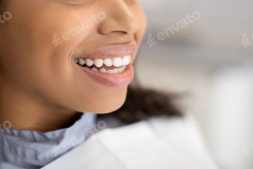 Preview: Teeth Whitening Concept. Closeup Of Beautiful Young African American Woman Widely Smiling