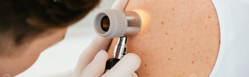Preview: panoramic shot of dermatologist in latex gloves holding dermatoscope while examining patient with