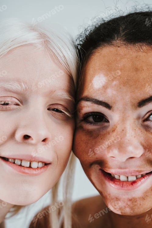 Preview: Group of multiethnic women